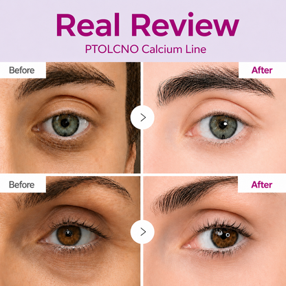 🔥LAST DAY 50% OFF!!Ptolcno Korean Calcium Dark Spot Eye Cream