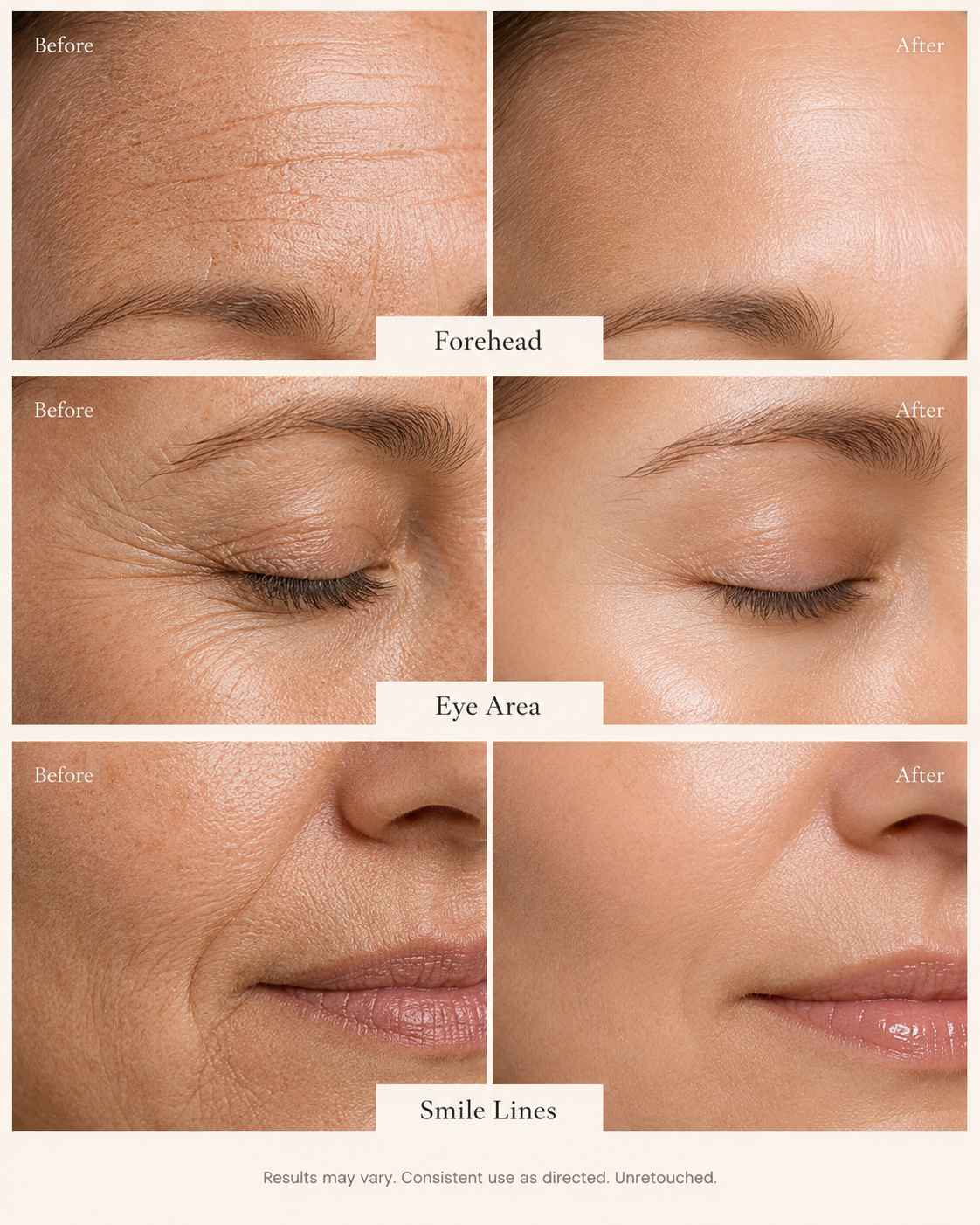⏳Eloreacare  Cream-Hydrating Anti-Aging Cream for Fine Lines, Dryness & Sensitive Skin